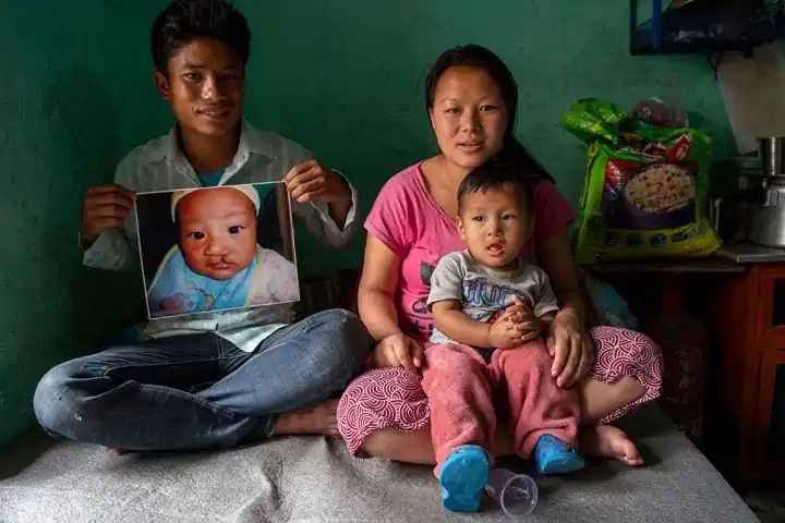 A family photographed in Sewa Foundation’s cleft care archive