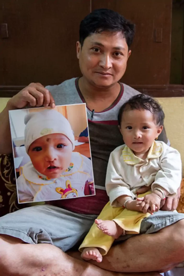 Before and after of a baby.