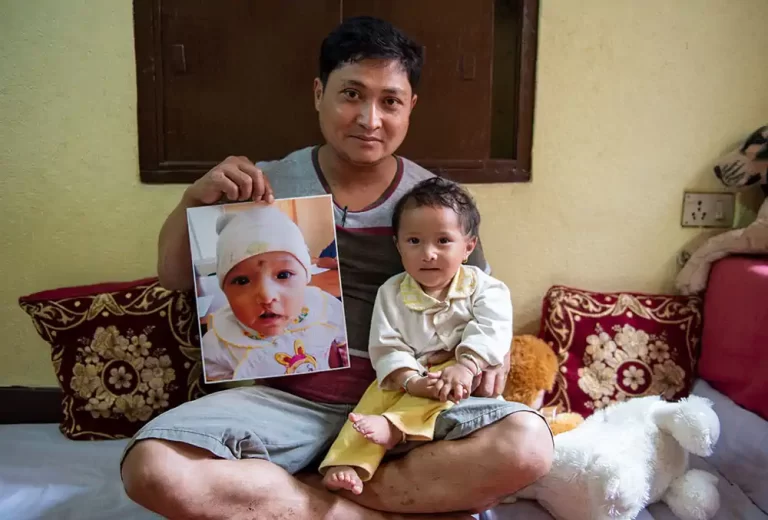 mrighna-with-father-after-free-smile-train-cleft-lip-palate-surgery-nepal