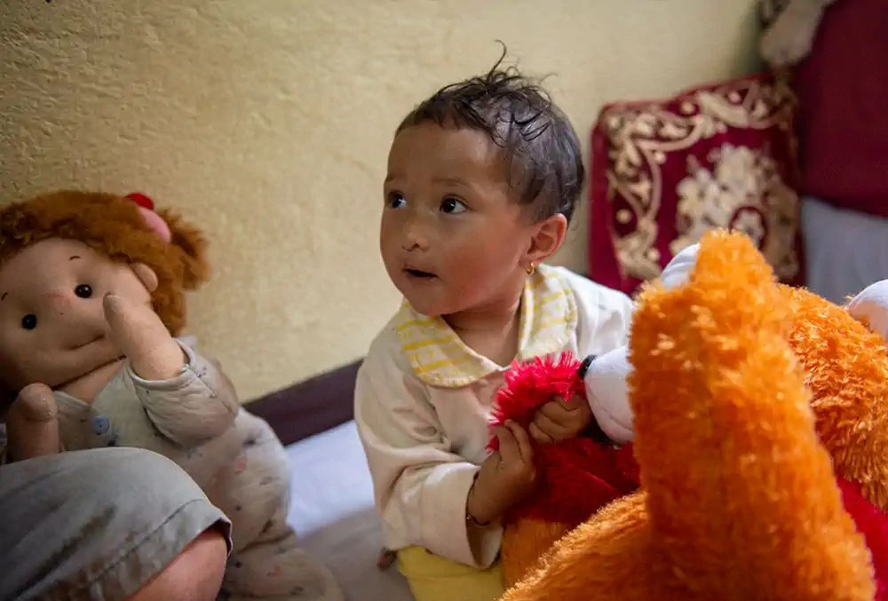 mrighna-with-toy-after-free-smile-train-cleft-lip-palate-surgery-nepal